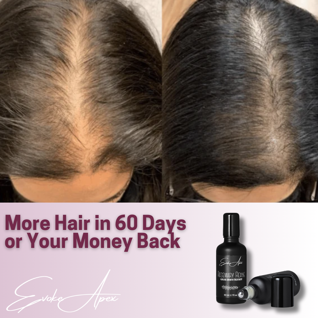 Mega Hair Growth Bundle - Rosemary Revive Hairline Growth Treatment and Hair Growth Stimulator - Evoke Apex
