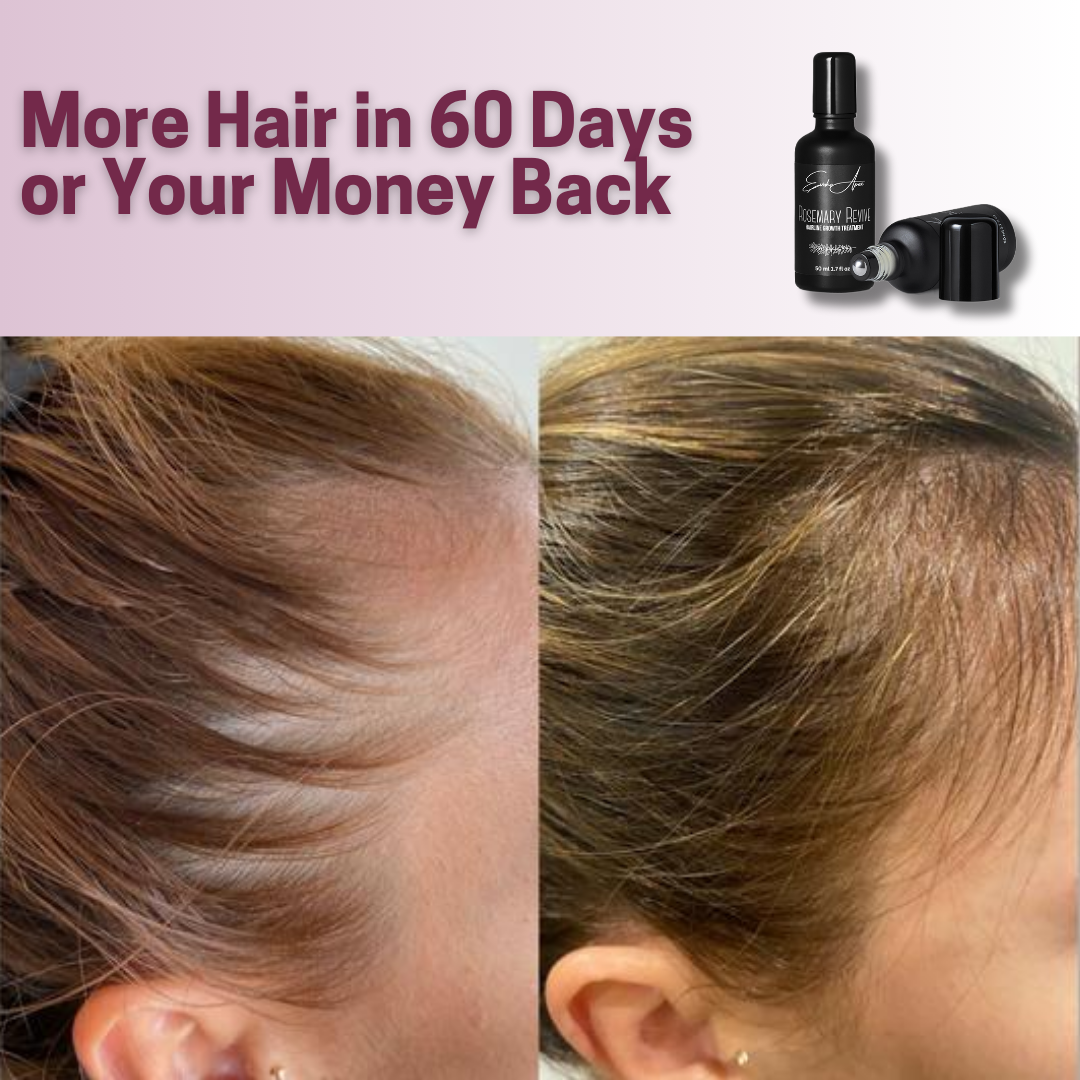 Rosemary Revive Hairline Growth Treatment