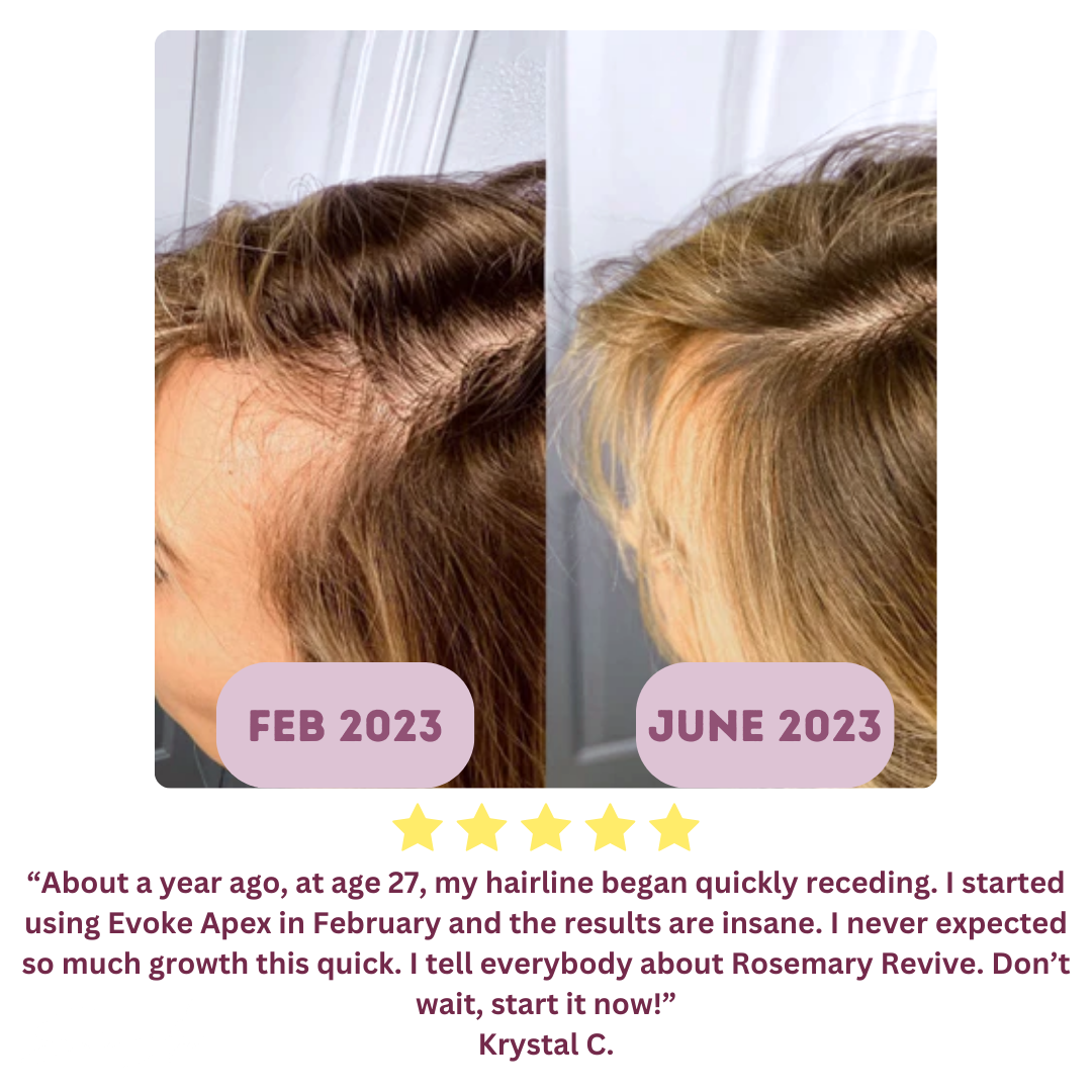 Hair Growth Supplement Bundle - 1 Month Supply - Evoke Apex