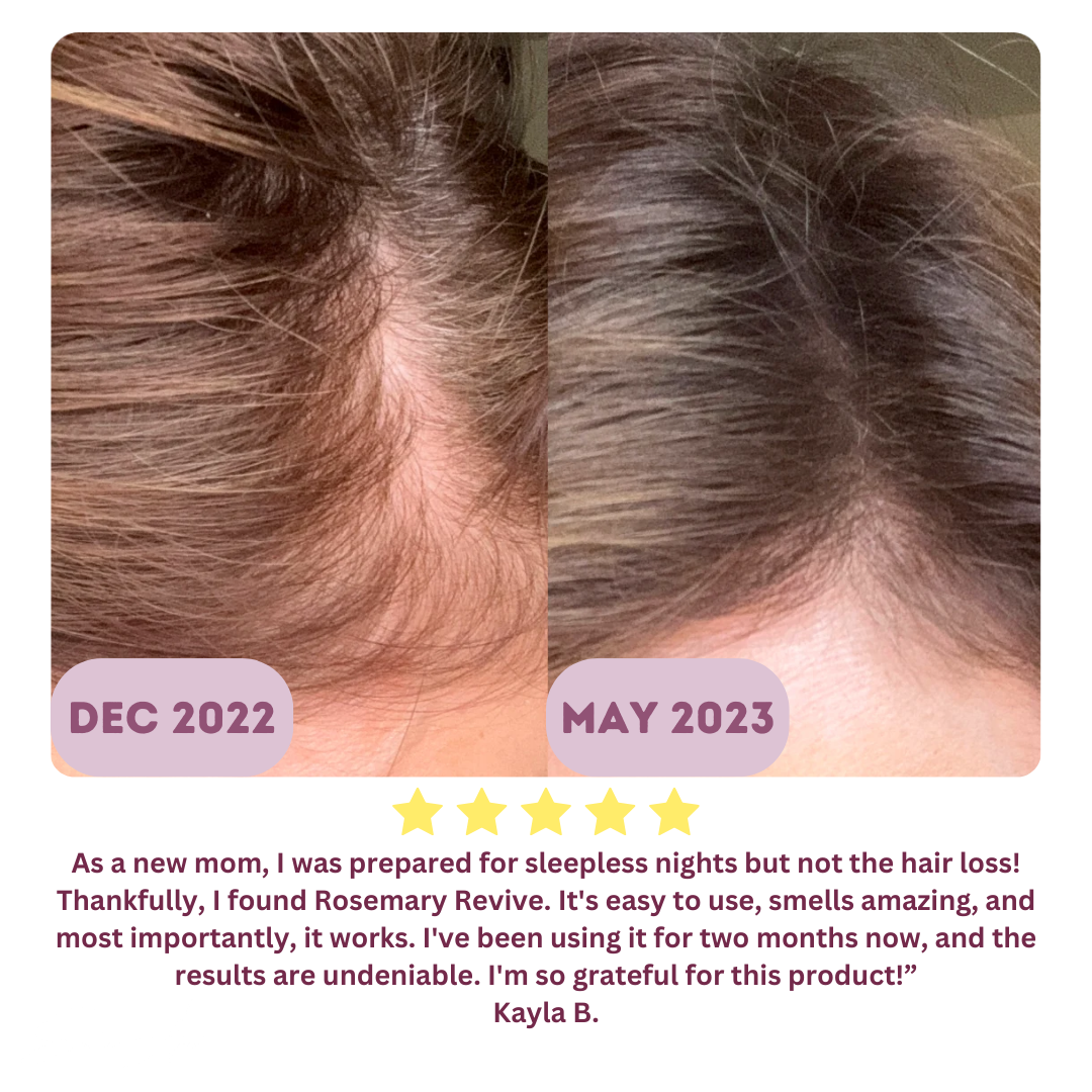 Rosemary Revive Hairline Growth Treatment