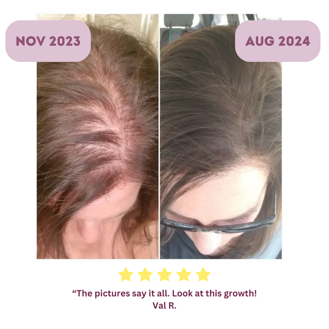 Hair Growth Supplement Bundle - 1 Month Supply - Evoke Apex